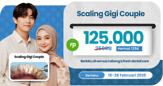 Scaling Gigi Couple